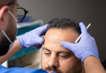 Hair Treatment in Istanbul: Transform Your Hair with Expert Care